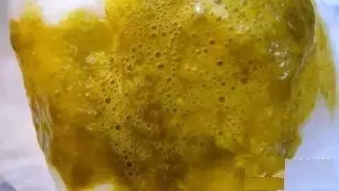 拉黄色便和黑色便是什么原因,黑绿色稀便是什么原因