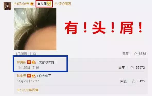 对抗头屑有捷径，重启9亿少女梦