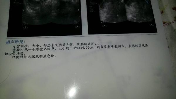 子宫前后位的全方位解析,子宫前位和后位哪个比较好