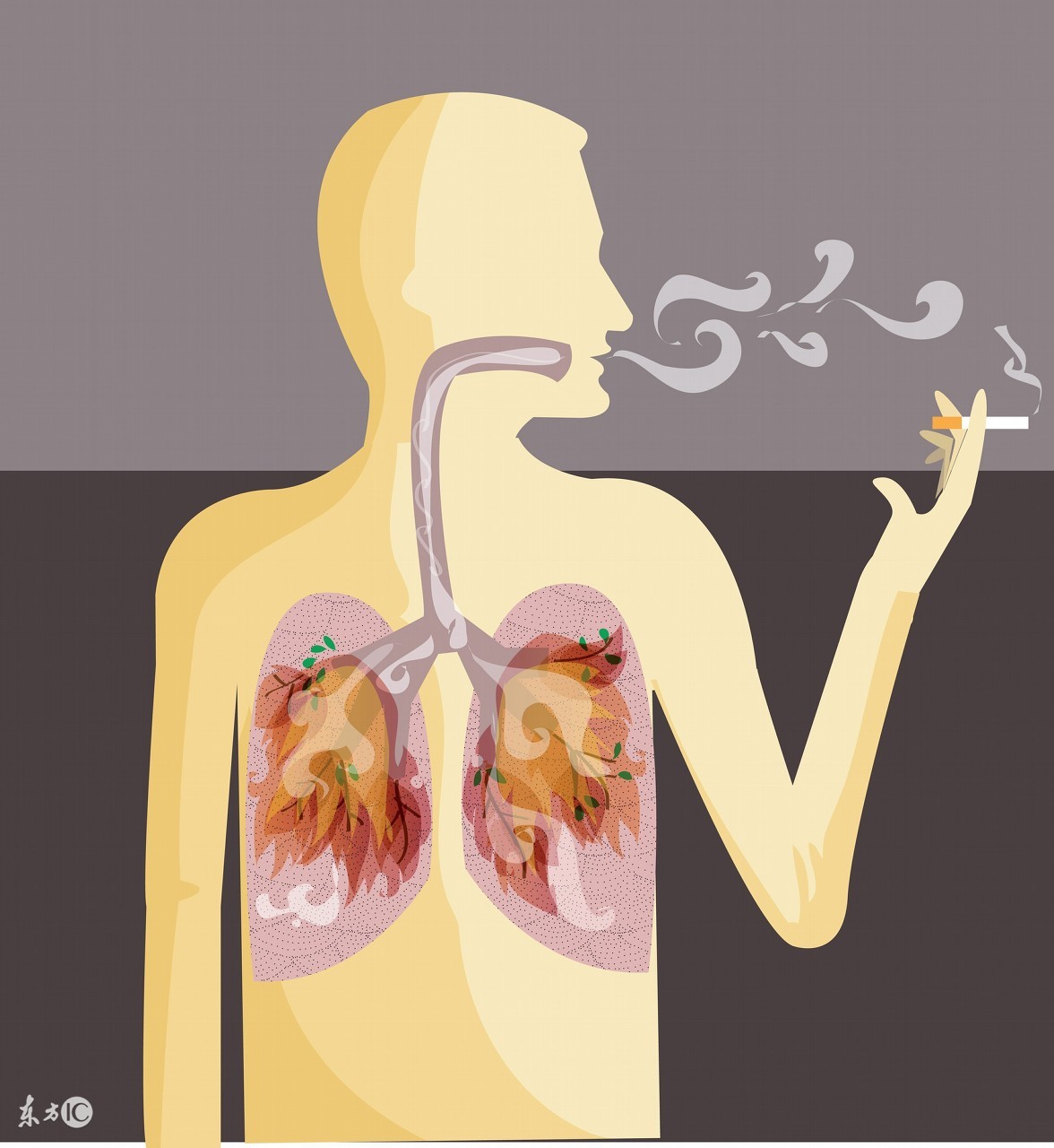 肺癌复发高峰期,肺癌复发率高吗