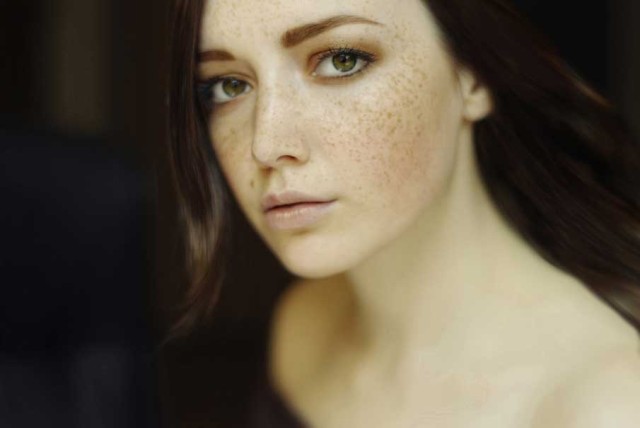 果酸换肤美白效果,果酸换肤和m22光子嫩肤哪个先做