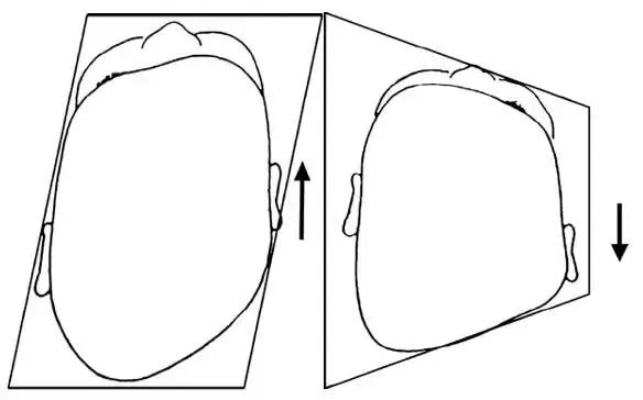 宝宝头型不正,宝宝扁头怎么纠正头型