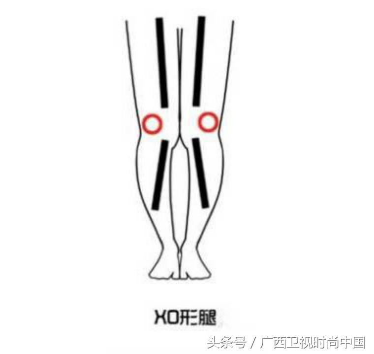 150腿粗小个子适合穿什么靴子,xo型腿适合穿什么样的靴子