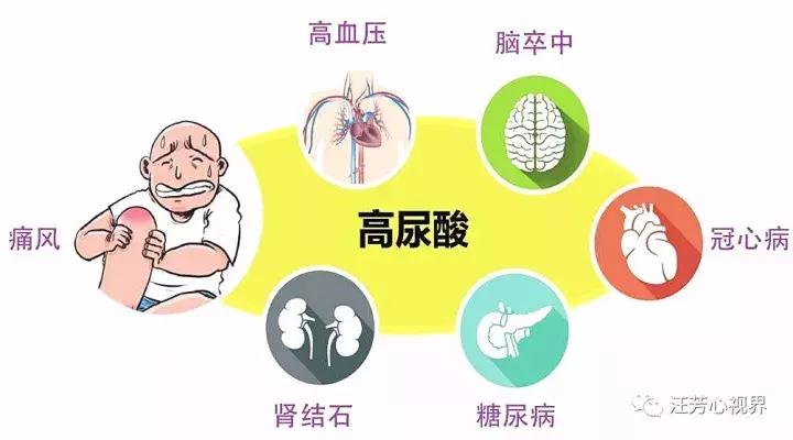 高尿酸血症一定要吃药吗,高尿酸不吃药的治疗方法