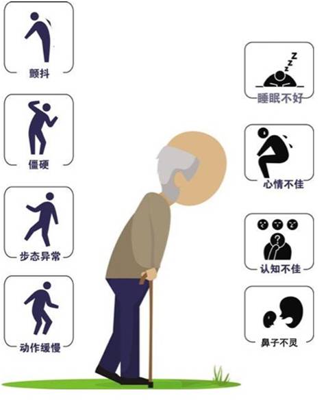 帕金森病手抖很严重怎么解决,帕金森病不只是老年人的疾病