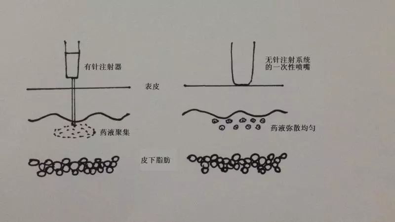 晕针的人打针前吃什么会缓解,晕针的人打疫苗现场