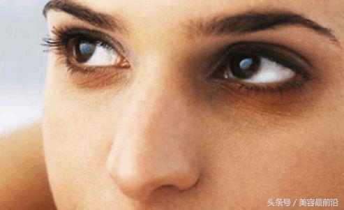 女人黑眼圈是什么意思,黑眼圈的女人好不好