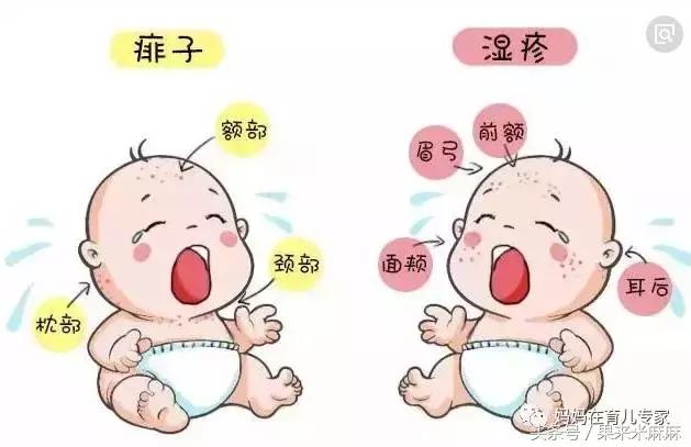 宝宝冬天长痱子怎么快速消除,一年四季都有痱子怎么办