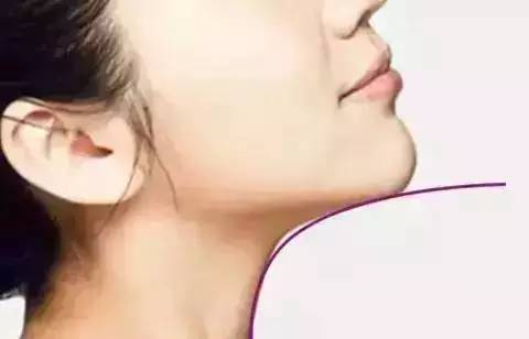 丰下巴用玻尿酸好还是自体脂肪好,玻尿酸丰下巴后要注意哪些问题