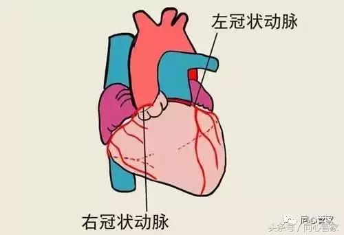 不做支架不搭桥中医调理冠心病,冠心病支架和搭桥的条件