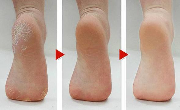 女生身体磨砂膏推荐,适合混合性皮肤用的磨砂膏