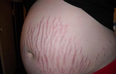 7个月孕妇身体有什么变化,孕期7个半月胎儿动得厉害