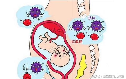 刚出生的婴儿得了溶血症,溶血症的孩子出生多久能发现