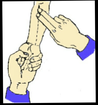 孩子发烧怎么办小儿推拿,孩子发烧怎么小儿推拿