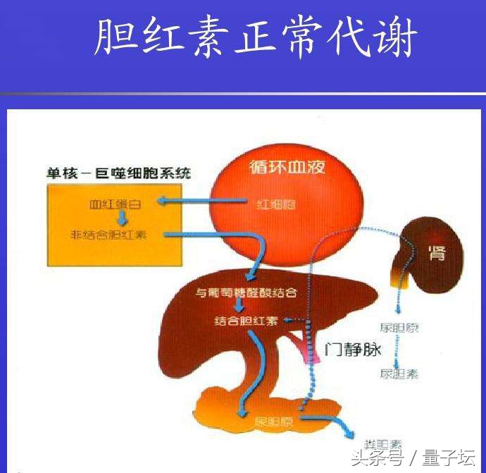 总胆红素偏高怎样调理最好,间接胆红素偏高要怎么调理