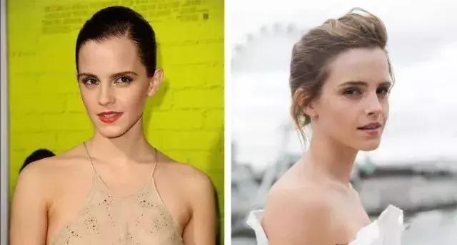 发际线不好看怎么剪,如何拯救90后的发际线