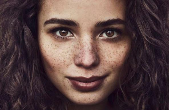 教你如何辨别斑的种类,一张图教你认识身体各个部位