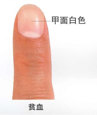 小小指甲,小小的指甲隐藏大大的健康秘密