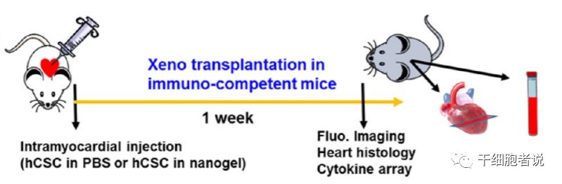 心肌梗死干细胞治疗,自身骨髓干细胞移植治疗心肌梗死
