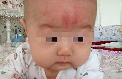 一岁半的宝宝摔下床摔到头了,宝宝摔下床大哭完吐就睡了