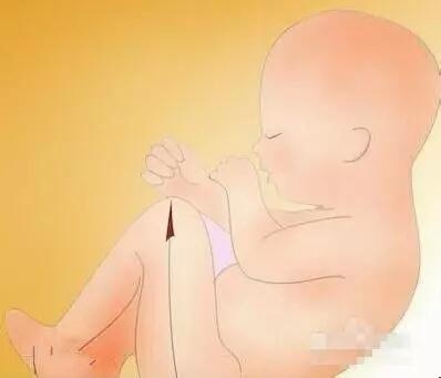 b超单怎么看圆形和长条形,b超单如何看是不是大高个