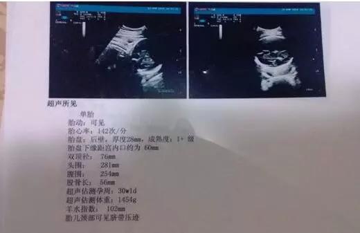 b超单怎么看圆形和长条形,b超单如何看是不是大高个