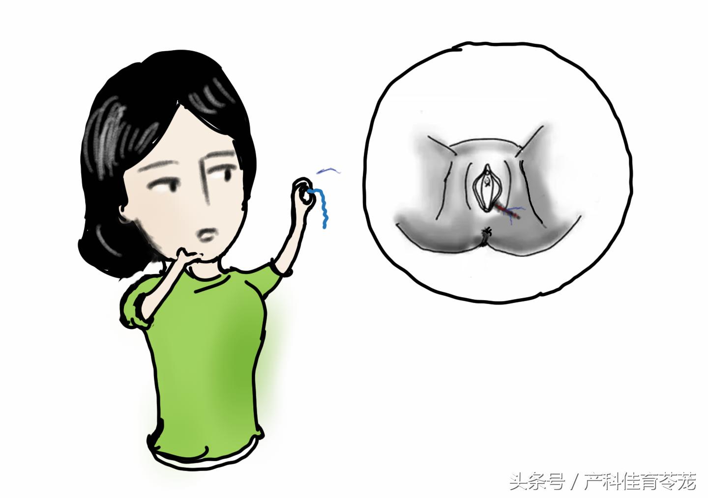 生孩子的时候,下面能不能不剪?