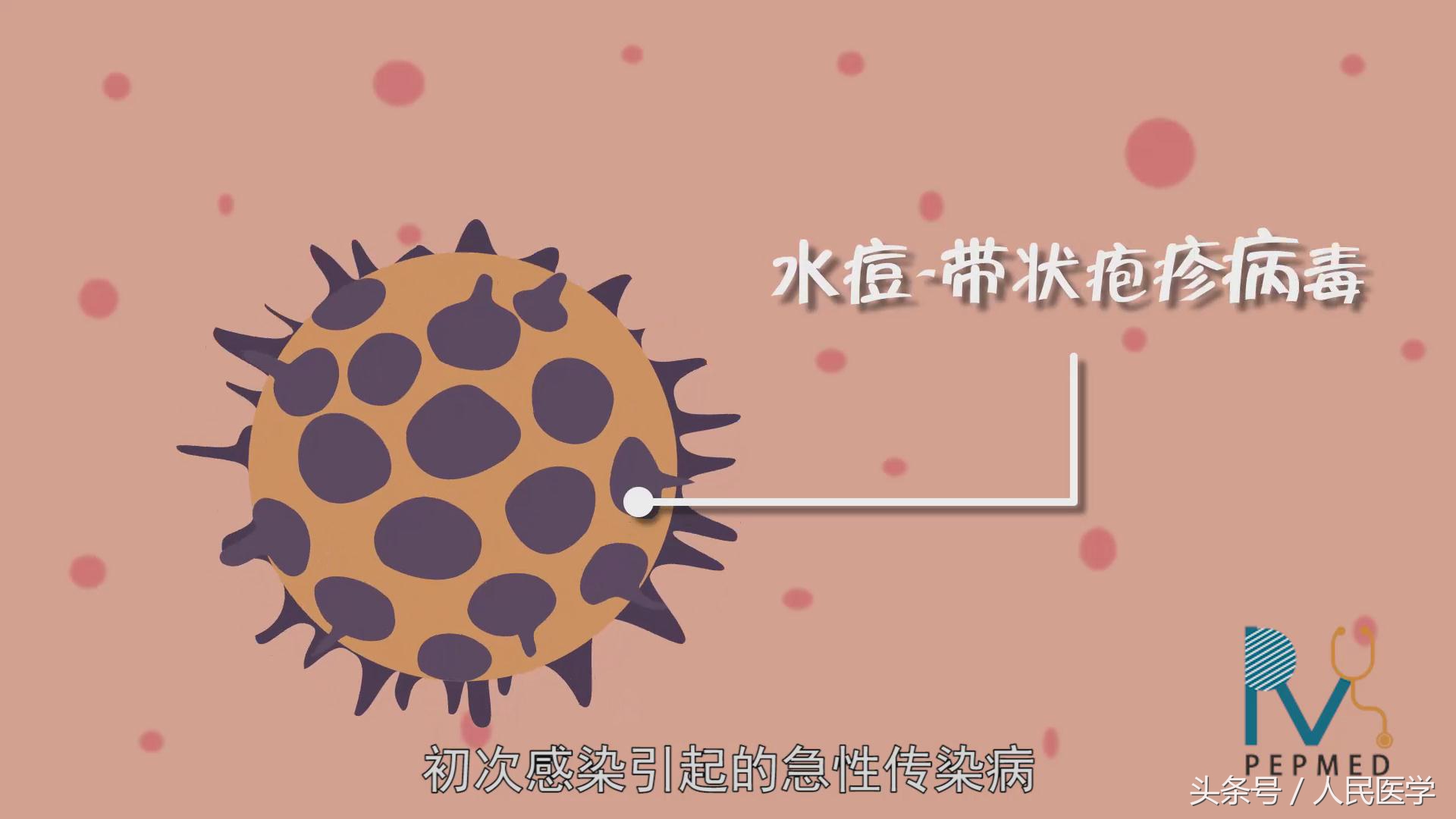 学校水痘疫情处置方案,学校水痘疫情