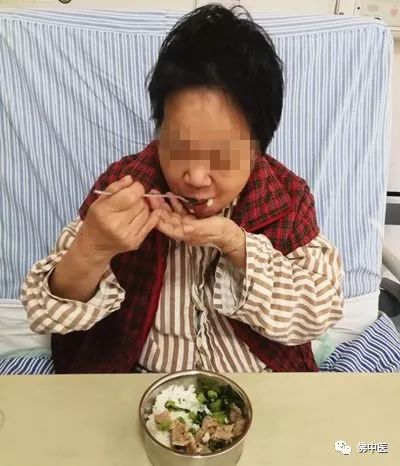 「专业」脑干梗塞合并吞咽障碍，脑病科吞咽专科护士有妙招