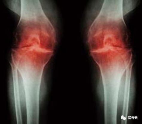 为什么经常夜里腿部抽筋？这些常识你需要知道