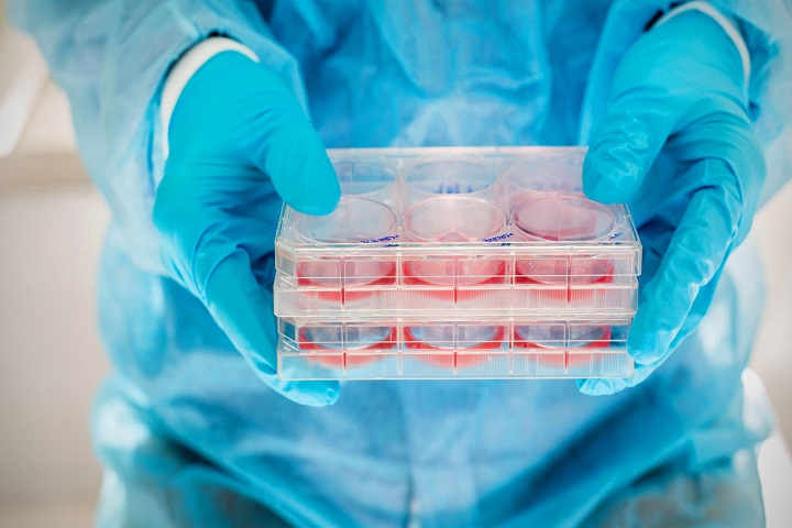 怎么补气血缺铁性贫血,贫血是造血功能有问题吗