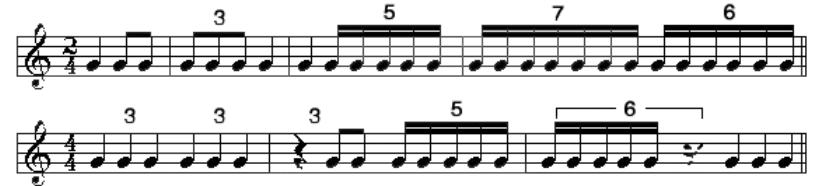 五线谱简单的入门知识,五线谱简单的入门知识吉他