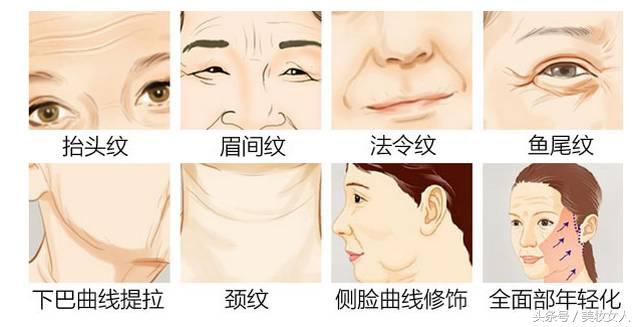 做完线雕后注意事项有哪些,做完线雕鼻子应该注意什么