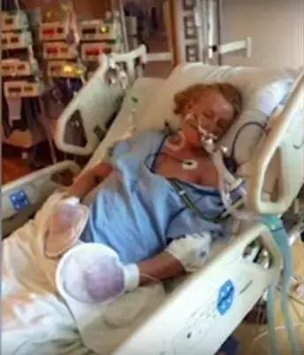 卫生棉条危害案例,用卫生棉条会中毒吗