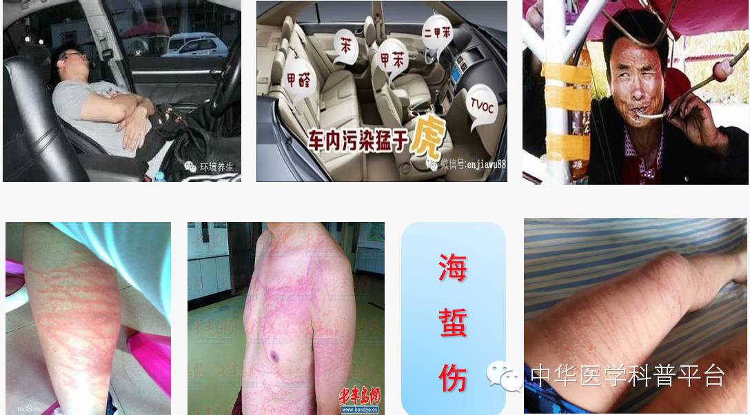 生活中哪些容易中毒,生活中各种食物中毒的表现