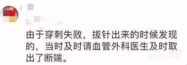 留置针断裂如何发现,留置针断裂入血管的处理方法