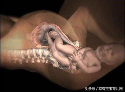 生产时，自然撕裂和侧切有什么不同？哪个恢复更快，该如何选择？