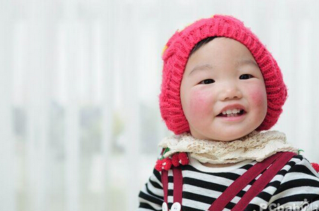 宝宝脸上高原红,冬季宝宝脸高原红用什么擦