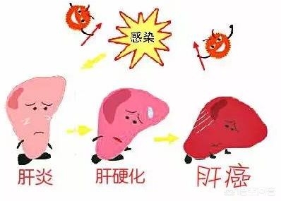 干扰素转氨酶升高,一过性转氨酶升高