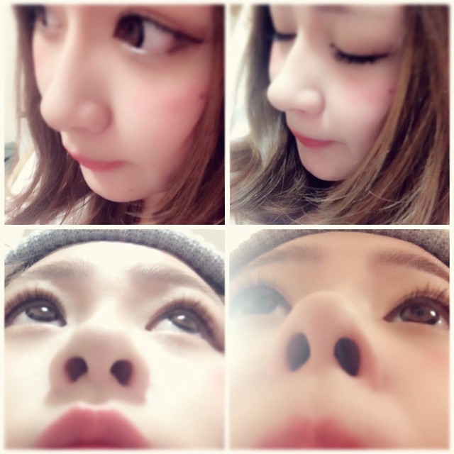 美鼻夹鼻梁增高器,缩小鼻翼鼻梁增高3d神器