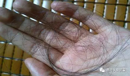 脱发案例丨菩叶毛囊赋活30天,生发效果立竿见影!