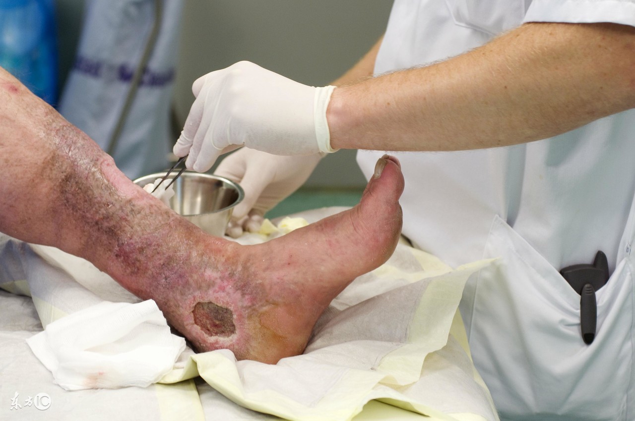 破伤风皮试怎么判断是阴还是阳,破伤风做皮试对身体有无影响