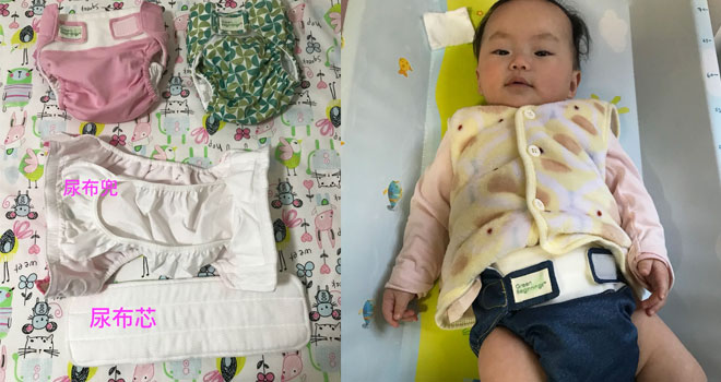 尿布疹推荐哪种纸尿裤,尿布vs尿片