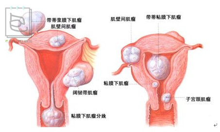 北美的红宝石蔓越莓,蔓越莓北美红宝石