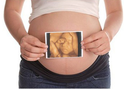 子宫出血没有流出孕囊是不是流产,孕囊已在子宫内为什么出血