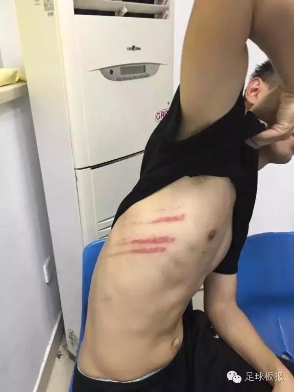 武汉宏兴球队,武汉全武行