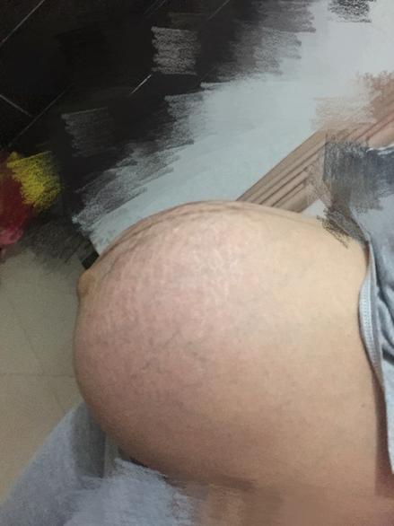 生孩子临产症状,要生宝宝前兆有哪些症状