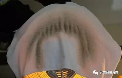 取暖器着火孩子冷静处理,婴儿被取暖器烤伤怎么办