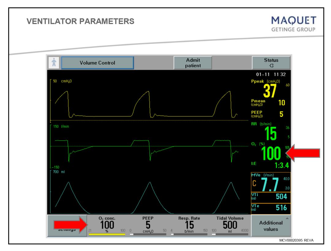 呼吸机基础知识最终版,呼吸机临床设置方法