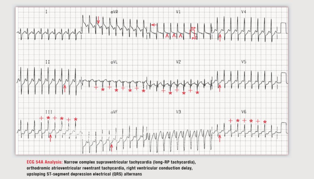 读心有术180期,读心有术视频讲解